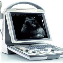 Ultrasound Scan Machine
